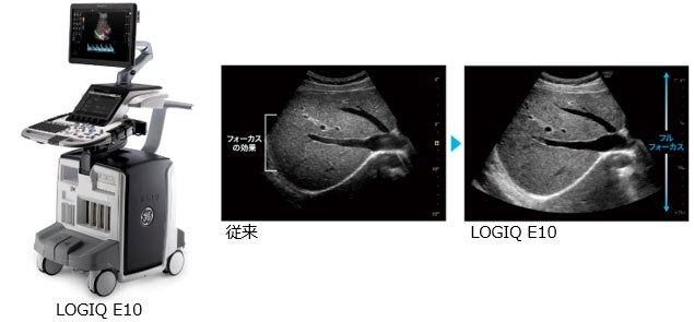 さらなる高画質を実現した汎用超音波装置 「LOGIQ E10」を発売 | GE HealthCare (Japan)