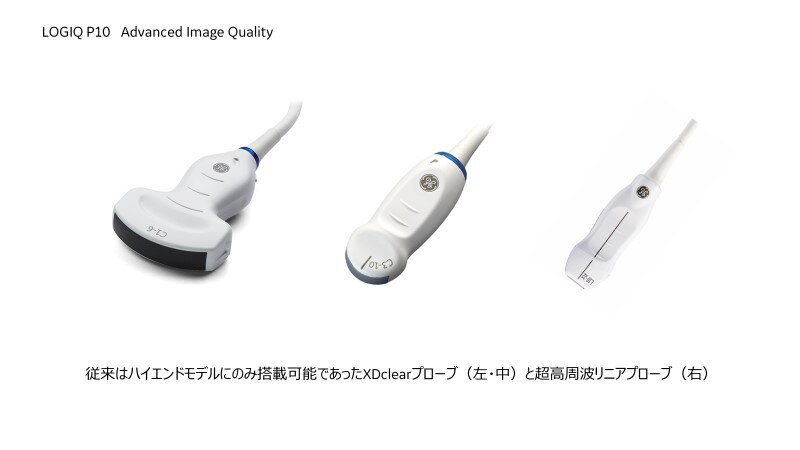 GEヘルスケア・ジャパン 日常診療に忙しい専門医の心強い味方 コンパクトな中に、ハイエンド画質と機能を凝縮した 汎用超音波画像診断装置 “LOGIQ  P10”を発売 | GE HealthCare (Japan)