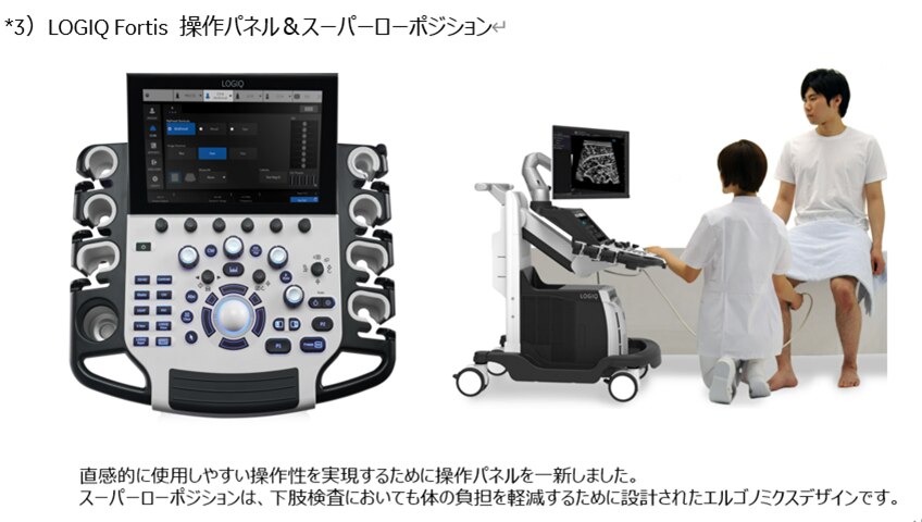 GEヘルスケア・ジャパン 汎用超音波画像診断装置 “LOGIQ Fortis”の販売