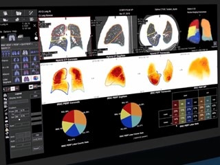 GEヘルスケア・ジャパン 核医学装置ワークステーション 「Xeleris V