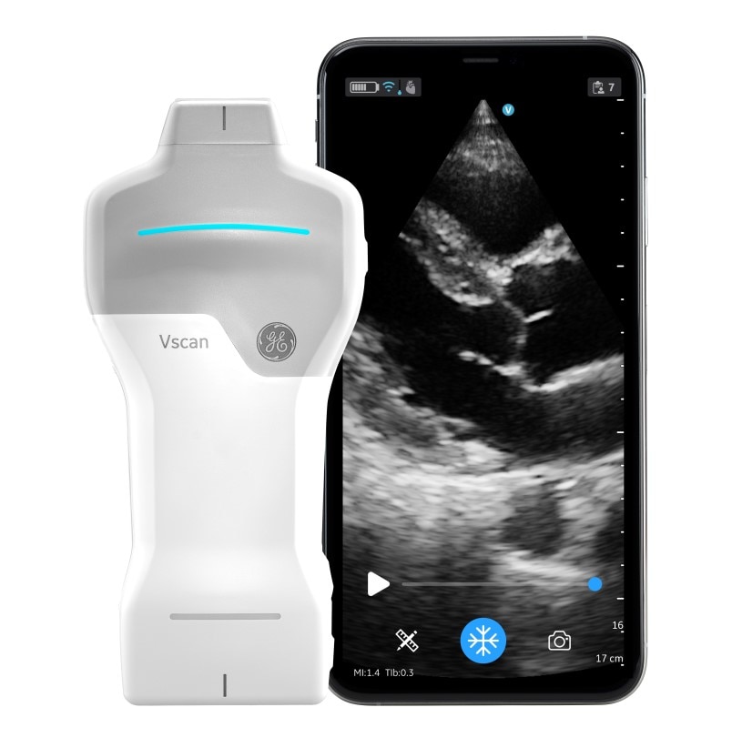 GEヘルスケア・ジャパン、循環器検査にも対応するポケットエコーVscan Air SLを発売 ー 場所を問わず、かつ質の高い心エコー検査を可能にし「医療が患者さんに近づく」をより一層後押しー  | GE HealthCare (Japan)