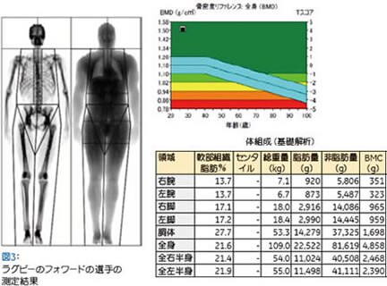 DXA法による 身体組成評価の有用性 | GE HealthCare (Japan)